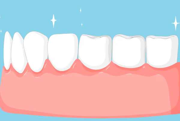 Gums Depigmentation