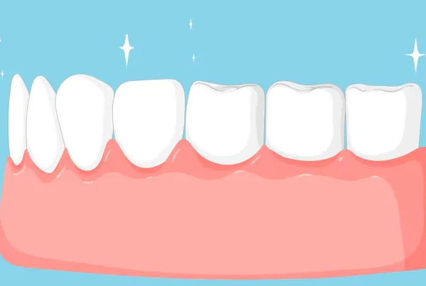 Gums Depigmentation