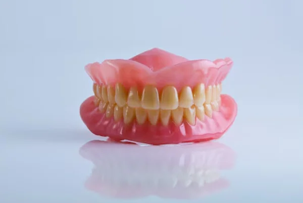 Flexible Dentures and RPD